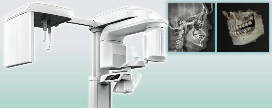 tomografia cone beam