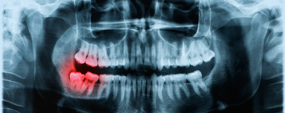 Radiología Radiología